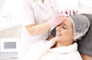 Chemical Peels & Acne Treatment: A Comprehensive Guide