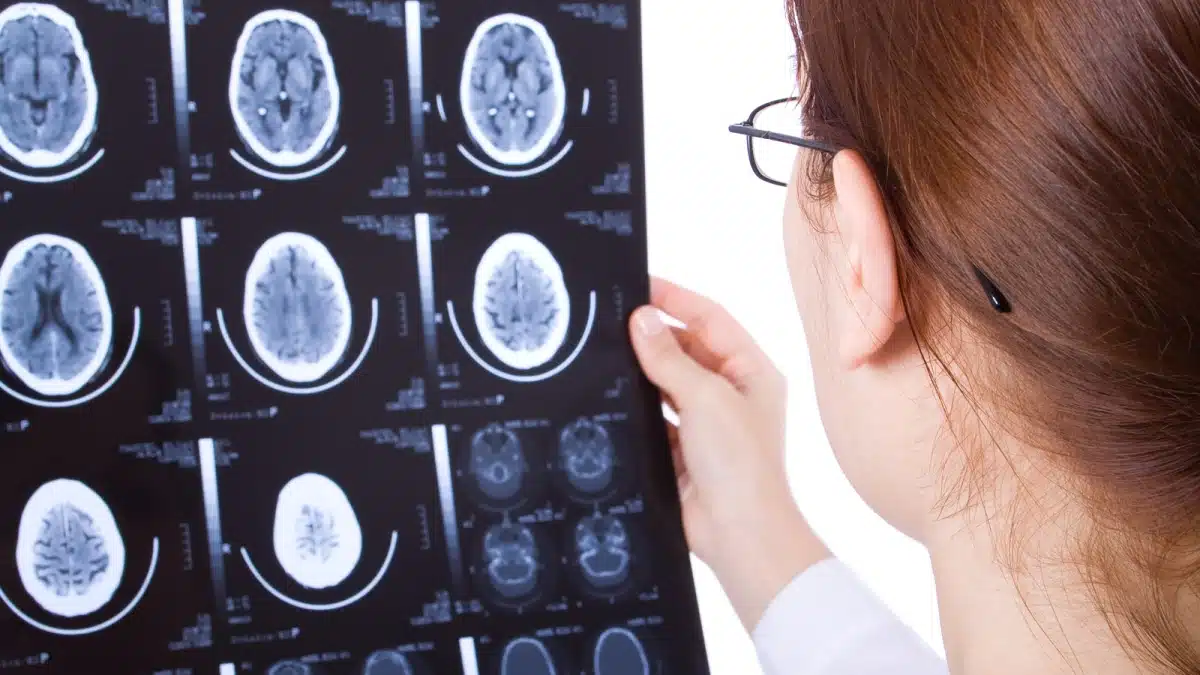 What Are The Legal Options After A Brain Stem Injury From A Car Crash?