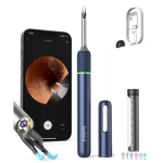 Bebird Note5 Pro Review: A Must-Have Gadget for Ear Care Enthusiasts