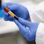 Transform Your Health Routine with Vitamin and HIV Tests at Home in Noida